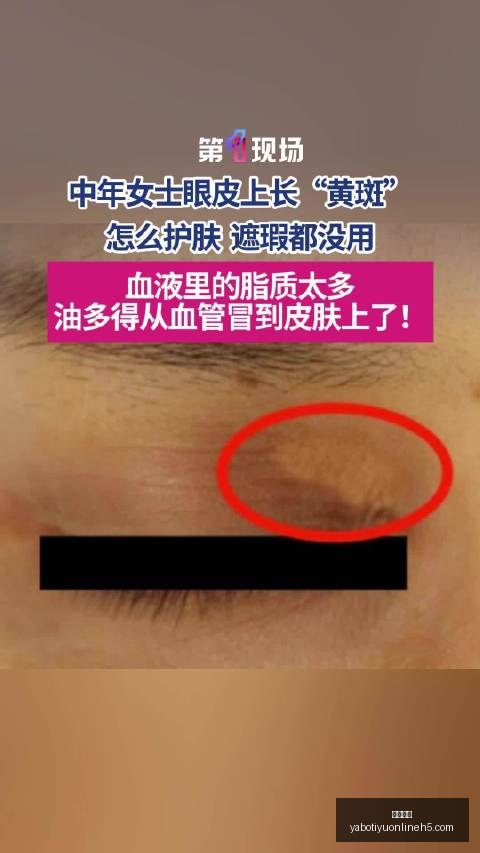 英雄联盟全,新赛季,开启新征程,亚博体育,亚博体育官网,亚博体育app,亚博体育下载